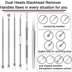 Earwax Removal Kit Manufacturer - OEM 8 Pcs Curette Set