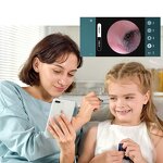 Ear Wax Vacuum Cleaner Factory - Promotional Smart Removal Tool Otoscope