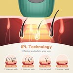 Portable IPL Hair Removal Machine Manufacturer - Multifunction USA Shipment