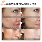 LED Face Mask Factory - Wholesale Electric Wireless Multi-Color