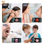 Ear Camera Cleaner Factory - Direct Sales Otoscope Ear Wax Removal Endoscope