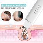 Facial Scrubber Factory - Wholesale Extractor With 4 Modes Spatula