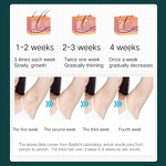 IPL Hair Removal Machine Manufacturer - OEM Portable Handheld for Body Face