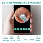 RF Eye Skin Tightening Instrument Manufacturer - EMS Skin Tightening Massager