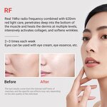 Skin Firming Massager Manufacturer - Anti Wrinkle Facial Tool