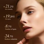 DPL Photofacial Device Manufacturer - PRO Skin Whitening Brightening