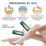 IPL Hair Removal Device Manufacturer - OEM/ODM Custom Handset