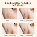 IPL Hair Removal Handset Manufacturer - OEM 510K Portable Home Use