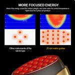 Ultrasonic Skin Scrubber Factory - Wholesale Portable Sonic Ultrasonic Peeling