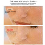 Face Tightening Beauty Device Manufacturer - Home Use Multi-Function Anti Wrinkle