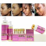 Skin Whitening Set Manufacturer - Acne Treatment OEM