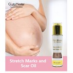 Stretch Mark Oil Manufacturer - Effective Repair