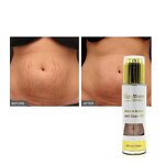 Stretch Mark Cream Manufacturer - Private Label Best