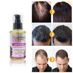 Hair Regrowth Serum Manufacturer - Private Label African