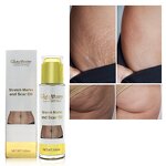 Stretch Marks Set Manufacturer - Wholesale Best