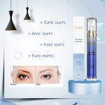 Dark Spot Pen Manufacturer - Anti Acne OEM