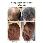 Anti Hair Loss Shampoo Manufacturer - Organic Natural
