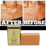 Whitening Soap Manufacturer - Concentrated Anti tach