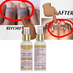 Lightening Spray Manufacturer - Gluta Intracellular