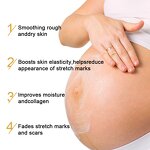 Stretch Marks Cream Manufacturer - Custom Logo Natural