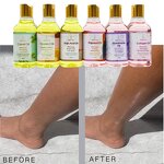 Vitamine C Oil Manufacturer - Lightening Complexion