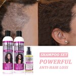 Anti Hair Loss Shampoo Manufacturer - Organic Natural