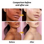 Whitening Pills Manufacturer - Black Spot Remover