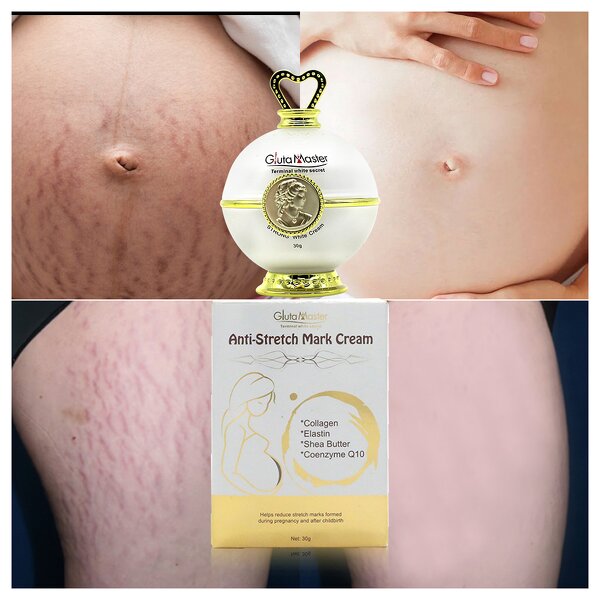 Stretch Marks Cream Manufacturer - Organic Natural