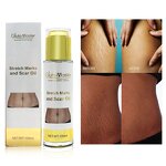 Stretch Marks Oil Manufacturer - Postpartum Hot Selling