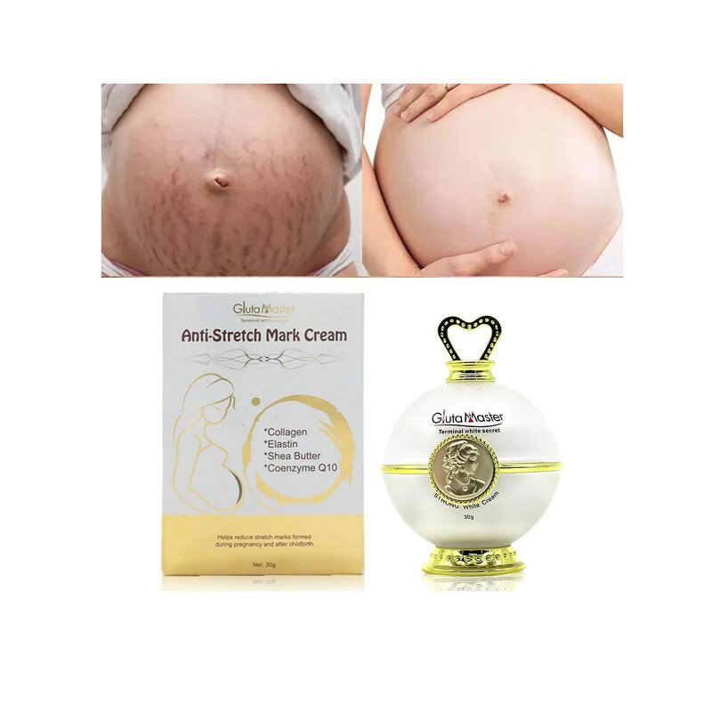 Stretch Marks Set Manufacturer - Effective Removal