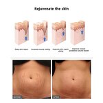 Stretch Mark Oil Manufacturer - Effective Repair