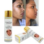 Whitening Toner Manufacturer - Acne Treatment OEM