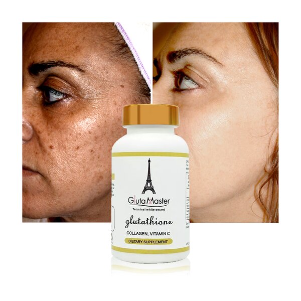 Whitening Pills Manufacturer - Black Spot Remover