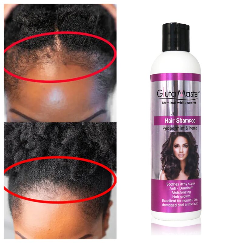 Hair Lotion Manufacturer - Smoothing Moisturizing