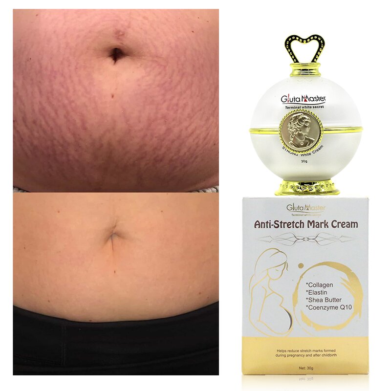 Cellulite Cream Manufacturer - Private Label Organic