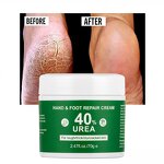 Foot Cream Manufacturer - Dead Skin Remover Urea