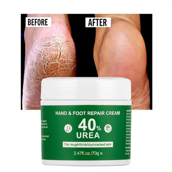 Foot Cream Manufacturer - Dead Skin Remover Urea