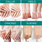 Foot Cream Manufacturer - Anti Crack Exfoliating