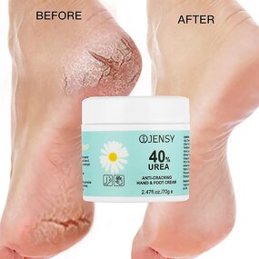 Foot Cream Manufacturer - Redness Dead Skin Removal