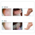 Foot Cream Manufacturer - Private Label Spa Repair