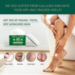 Foot Cream Manufacturer - Dead Skin Remover Urea