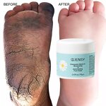 Foot Cream Manufacturer - Custom Herbal Peeling