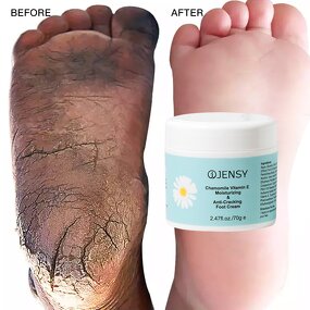 Foot Cream Manufacturer - Custom Herbal Peeling