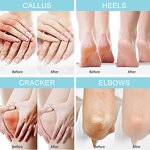 Foot Cream Manufacturer - 40% Urea Peppermint