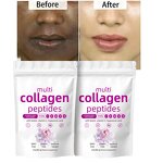 Collagen Peptides Powder Manufacturer - 100% Natural Herbal