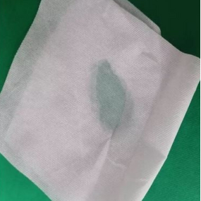 SMS Nonwoven Manufacturer - Good Absorbent Hydrophilic for Diaper Material