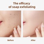 Anti-Acne Kojic Acid Soap Manufacturer - Custom 100g Lemon Fragrance Handmade Skin Care