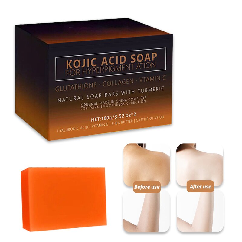 Anti-Acne Kojic Acid Soap Manufacturer - Custom 100g Lemon Fragrance Handmade Skin Care