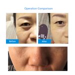 Collagen Sheet Mask Factory - 2023 Water-Soluble Radar Silk Protein