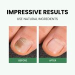 Cuticle Oil Factory - Moisturizing Repairs Overnight Paraben-Free Cruelty-Free